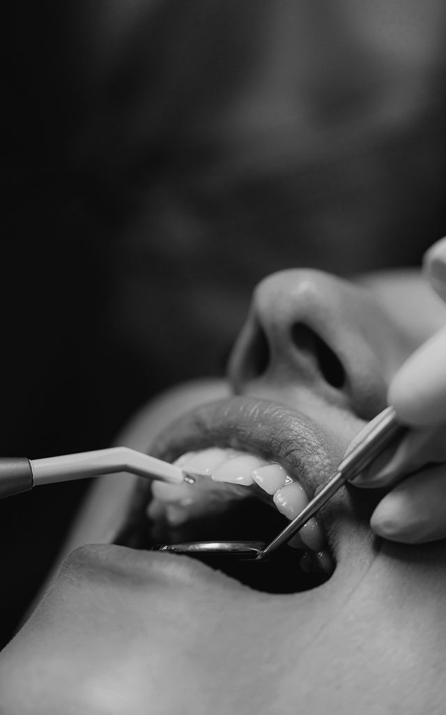 Tratamiento dental en curso en Clínica Dental Sakbé, Narvarte
